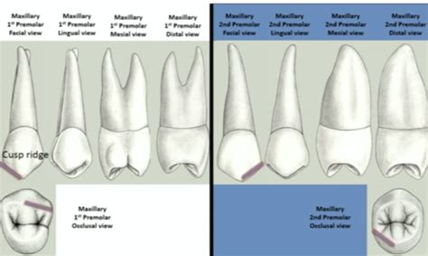 Differences between Maxillary 1st & 2nd Premolar .